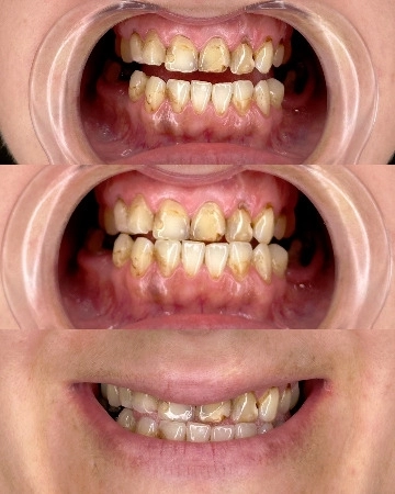 mudr-senad-ligata-portfolio-2