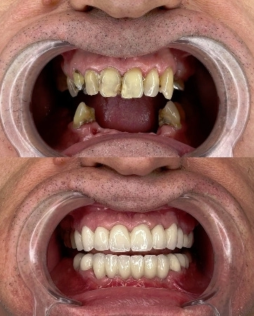 mudr-senad-ligata-portfolio-1