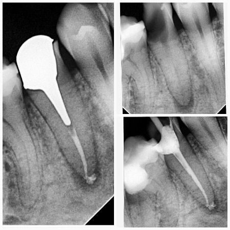 mudr-senad-ligata-portfolio-5