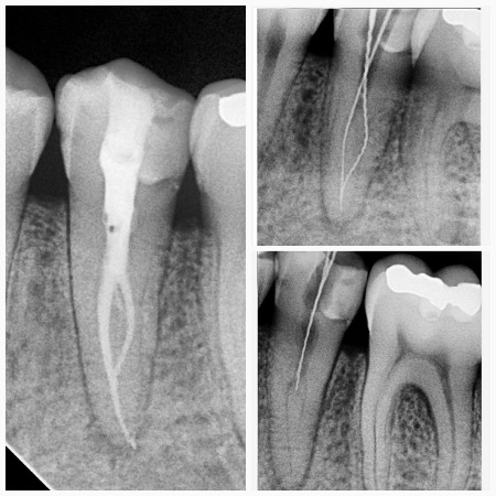 mudr-senad-ligata-portfolio-7